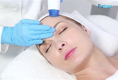 Futera Dots - Non Invasive Fractional RF: Full Face and Neck