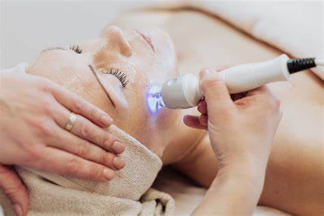 Medlite C6 Laser Treatment: Full Face