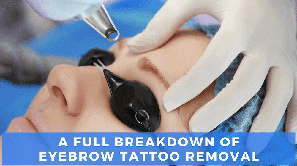 Cool Laser Eye Brow Tattoo Removal