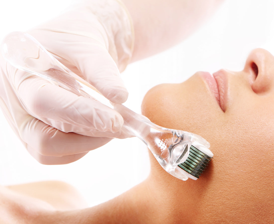 Micro-needling Treatment